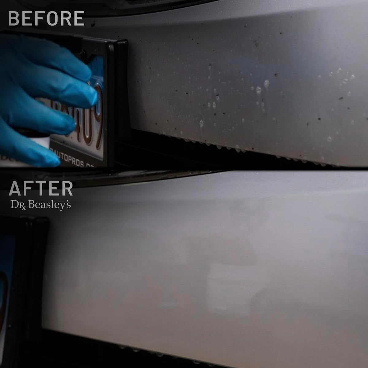 Bug Barrier Prescription for Auto - Complete Bug Removal and Protection, Breaks down and Removes Stubborn Stains, Includes Sponge and Towels