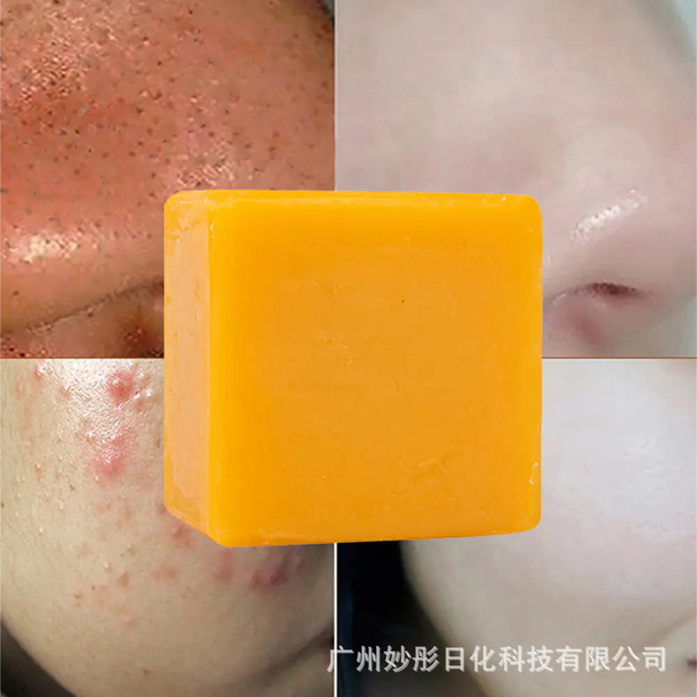 Turmeric Soap Handmade Cleansing Bar with Essential Oils